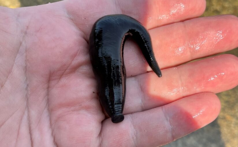 leech in person's hand