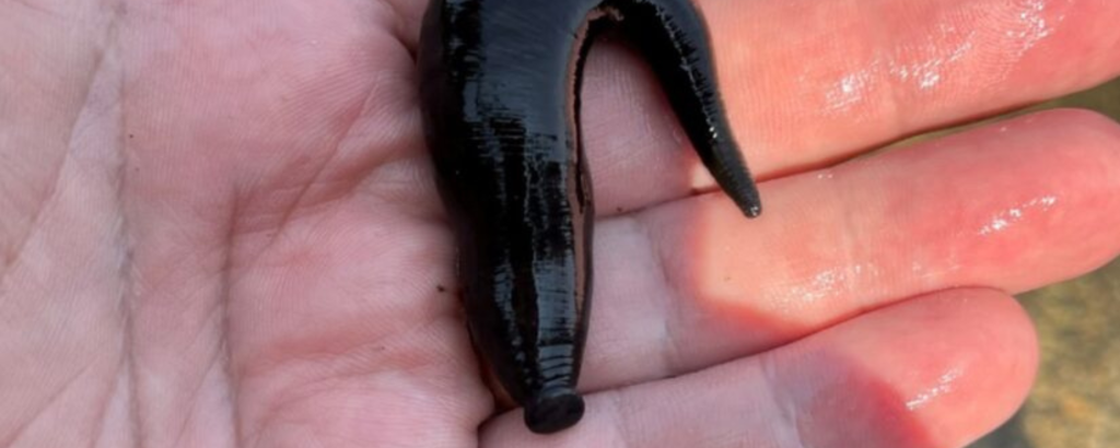 leech in person's hand